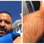 DJ Khaled Documents Jet Ski Accident on Instagram