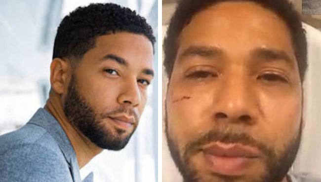 Jussie Smollett Now Officially Suspect In A Criminal Invesdtigation -Anthony Gugliemi