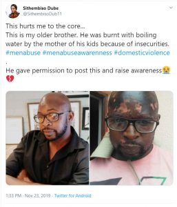 Man raises awareness of domestic violence against men after his wife baptized him with hot water
