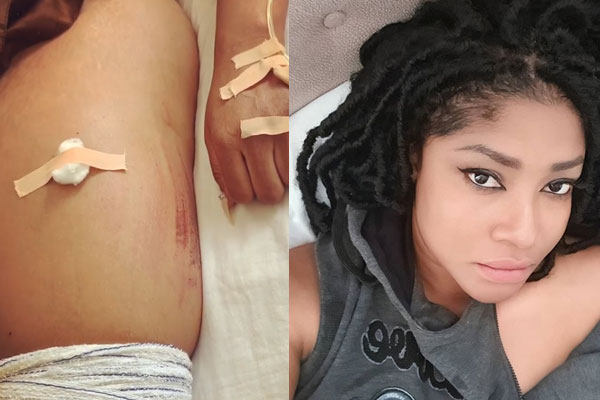 Nollywood actress, Angela Okorie survives after falling into an uncovered drainage
