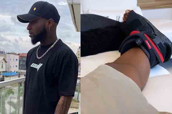 Davido sprains his ankle