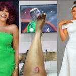 Reactions as Eve Esin sustains injury from Super Eagles’ match against South Africa